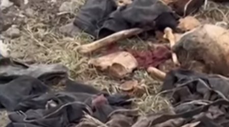 Xocalıda əl-ayağı bağlı skelet qalıqları aşkarlanıb - VİDEO