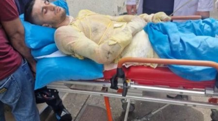 Qız qaçıran qazi özünü yandırıb