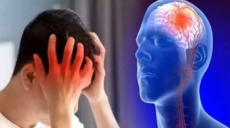 İnsultdan sonra hərəkəti tam bərpa etmək mümkün olacaq