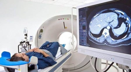 Vətəndaşlar bundan sonra MRT və KT üçün 20% ödəniş etməli olacaqlar