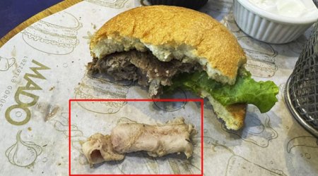 Uşaq üçün sifariş edilən yeməkdən ‘qığırdaq’ çıxdı – Restoran açıqlama vermir