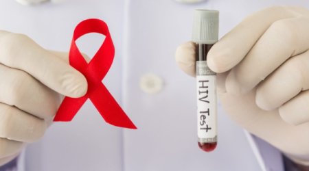 Названо число ВИЧ-инфицированных в Азербайджане