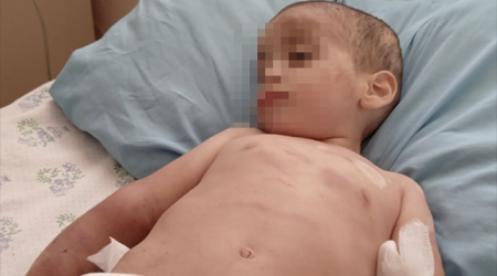 Ağdamda iki yaşlı uşaq döyülüb