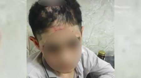 14 yaşlı yeniyetmə zorakılıq iddiaları ilə bağlı səhiyyə müəssisəsinə yerləşdirilib