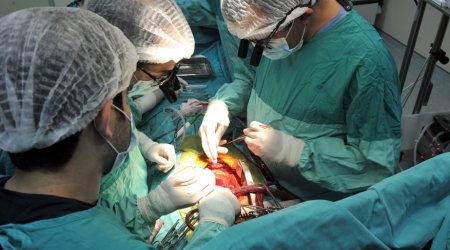 Azərbaycanda ilk dəfə meyit donorun ürəyi köçürülüb
