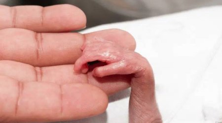 Xəstəxanın ərazisində ağacın altında 34-36 həftəlik ölü döl tapılıb