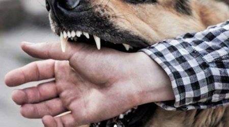 Bakının bu qəsəbəsində 1 ay ərzində 65 nəfəri it dişləyib