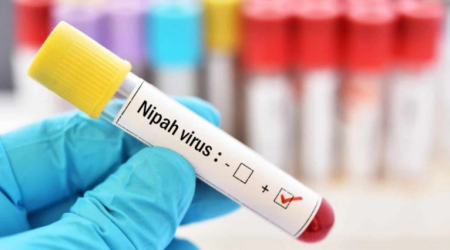 Nipah и глобальная уязвимость: может ли риск дойти до Азербайджана?