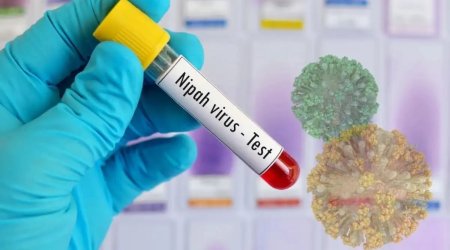 ÜST Hindistanda Nipah virusu ilə bağlı vəziyyəti yaxından izləyir