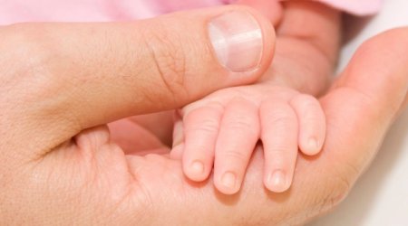 Peyvənddən şoka düşən körpə ölüb