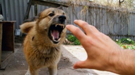 Biləsuvarda son 15 gündə 26 nəfəri it dişləyib