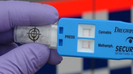 Azərbaycanda narkoloji xidmətlərin genişləndirilməsi təklif olunur