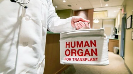 Kök hüceyrələrin transplantasiyasının say həddi 20-dən 50-yə qaldırılıb - qərar