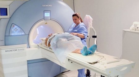 Число компьютерных томографов в медучреждениях TƏBİB сократилось до 30
