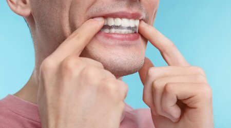 İnsana yenidən diş çıxaran preparat hazırlanıb