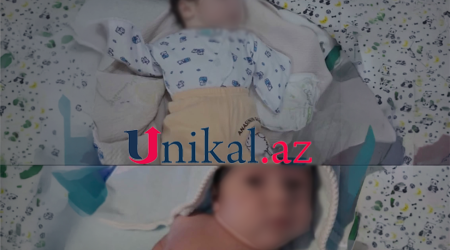 Sabunçuda qolları olmayan körpə doğulub, anası ondan imtina edib