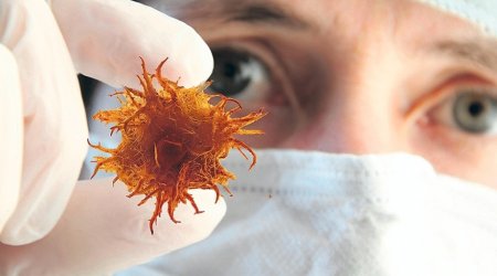 Azərbaycanda ilk dəfə xərçəng diaqnozu qoyulanların sayı 15 ildə 73% artıb