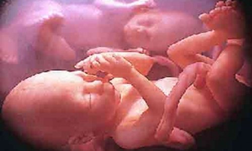 Bakıda doğum evində ŞOK: abort olunan uşaq yaşadı