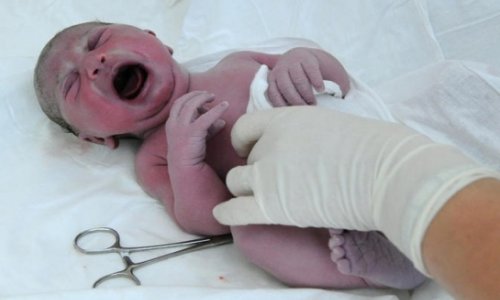 Женщина родила ребенка спустя 3 месяца после смерти