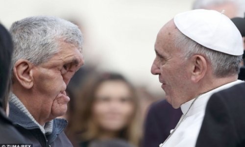 Папа римский обнял человека без лица -ФОТО
