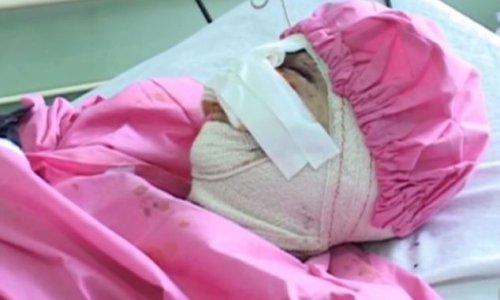 Афганец отрезал жене нос и губы -ФОТО+ВИДЕО