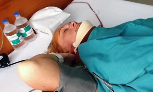 Россиянку парализовало после нападения рыбы-иглы во Вьетнаме