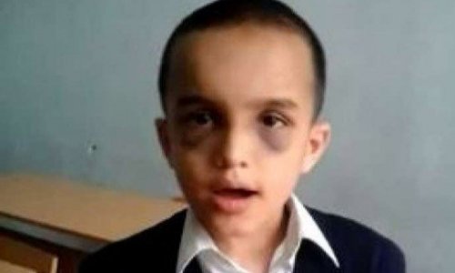 7 yaşlı Nihad: “Afaq müəllimə başıma taxta ilə vurdu” - VİDEO