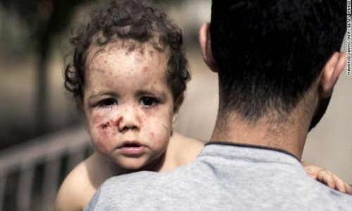 For children of Gaza, trauma can be worse than war itself