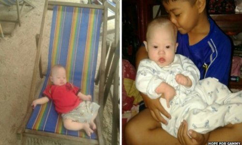 Australian couple abandon surrogate Down's Syndrome baby