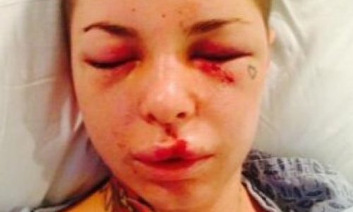Actress tweets pictures of alleged brutal beating by boyfriend - PHOTO