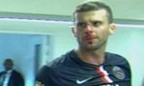 Thiago Motta head-butted