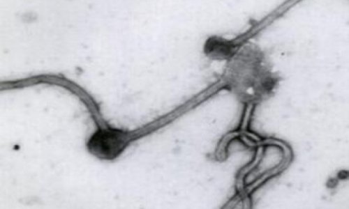 Several persons in Azerbaijan call “hotline” on suspicion of Ebola virus