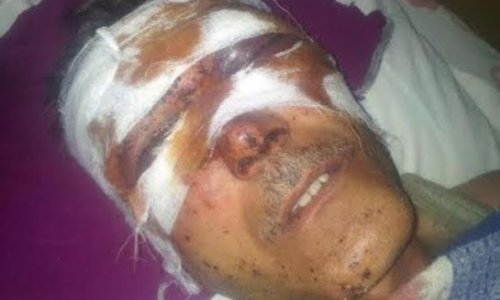 Beaten journalist of radio Liberty Ilgar Nasibov - PHOTOS