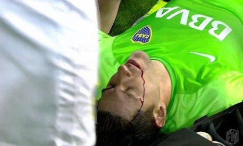 Goalkeeper struck by rock thrown by fans in shocking incident