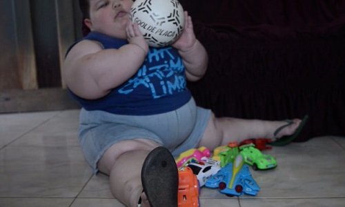The 3-year-old boy who weighs 150lb due to syndrome - PHOTO