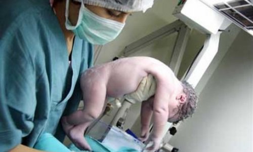 Минздрав о смерти новорожденного в Сумгаите