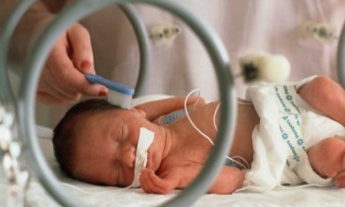'Kangaroo care' key for premature babies