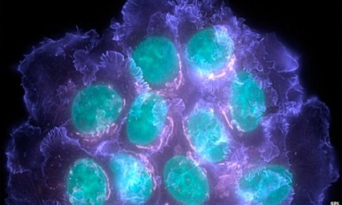 Cancer diversity 'threatens drugs'