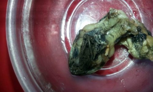 Woman finds ‘snake head’ in frozen bag of green beans