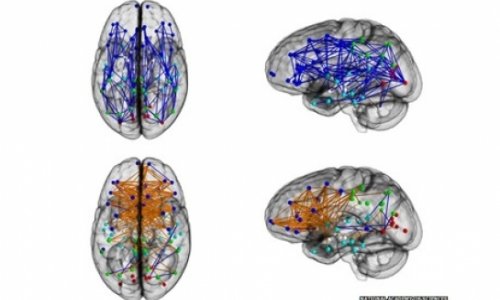 Men and women's brains are 'wired differently'