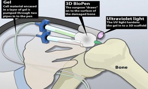 'Bio-pen' could allow doctors to draw-on human cells