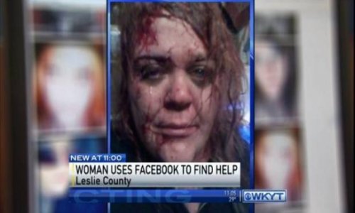 Facebook selfie alerts police and saves life