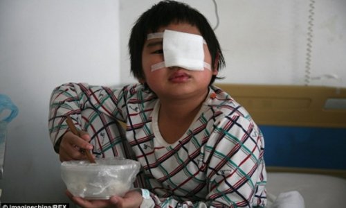 Teacher orders classmates to slap boy in the eye 40 times