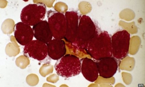 Antibody machinery can misfire and cause leukaemia