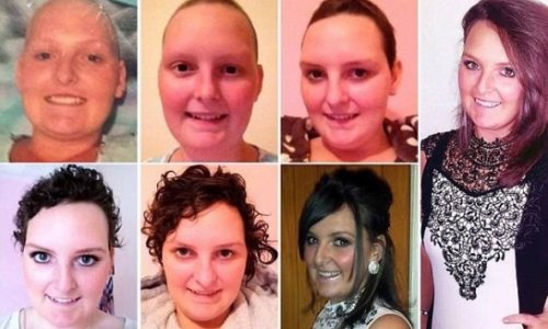 Cancer survivor left bald after treatment charts recovery
