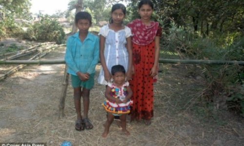 Teenager stopped growing just before her second birthday - PHOTO