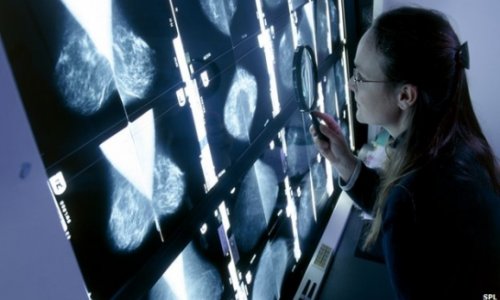 Cancer 'tidal wave' on horizon, warns WHO