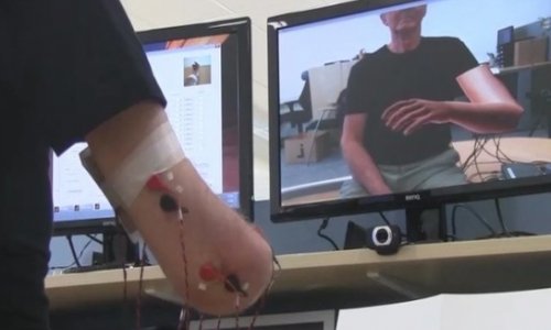 Virtual arm eases phantom limb pain