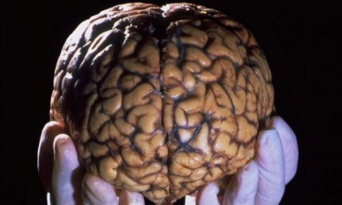 How building a library of brains could save lives