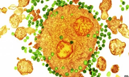 Immune upgrade gives 'HIV shielding'